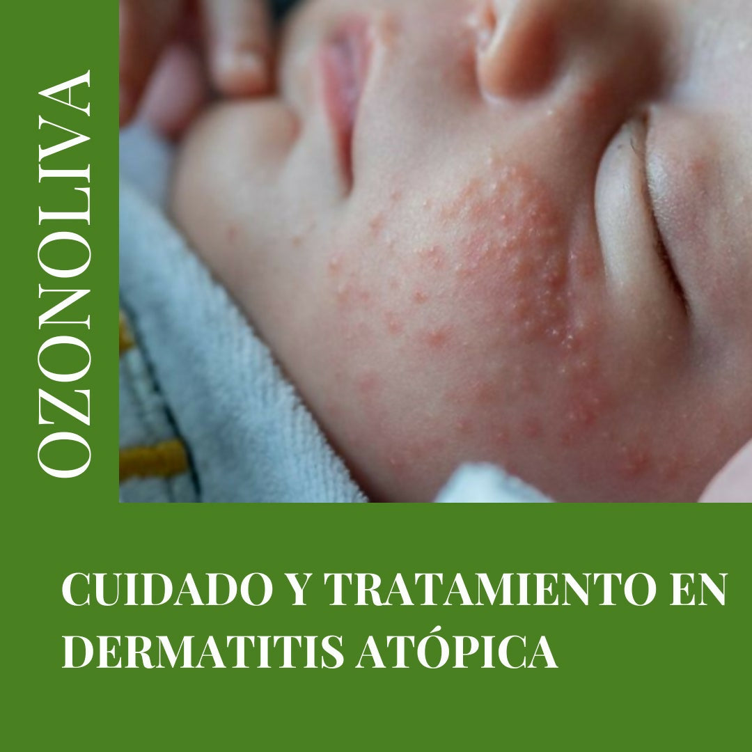 Aceite Ozonizado/Uso Tópico/Multiuso